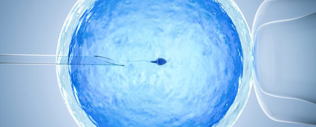 asthenozoospermia